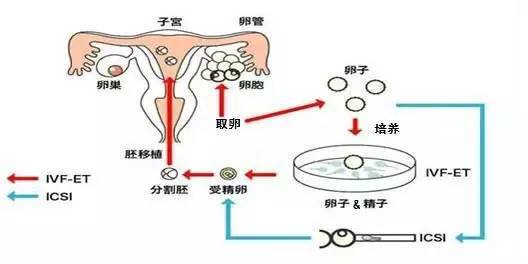 济南试管助孕